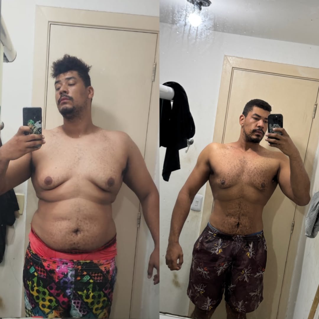 Resultado Real - Antes e Depois